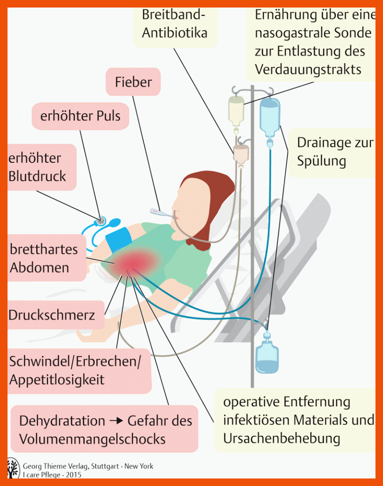 56. Verdauungssystem - PflegepÃ¤dagogik - Georg Thieme Verlag für arbeitsblätter pflege kostenlos