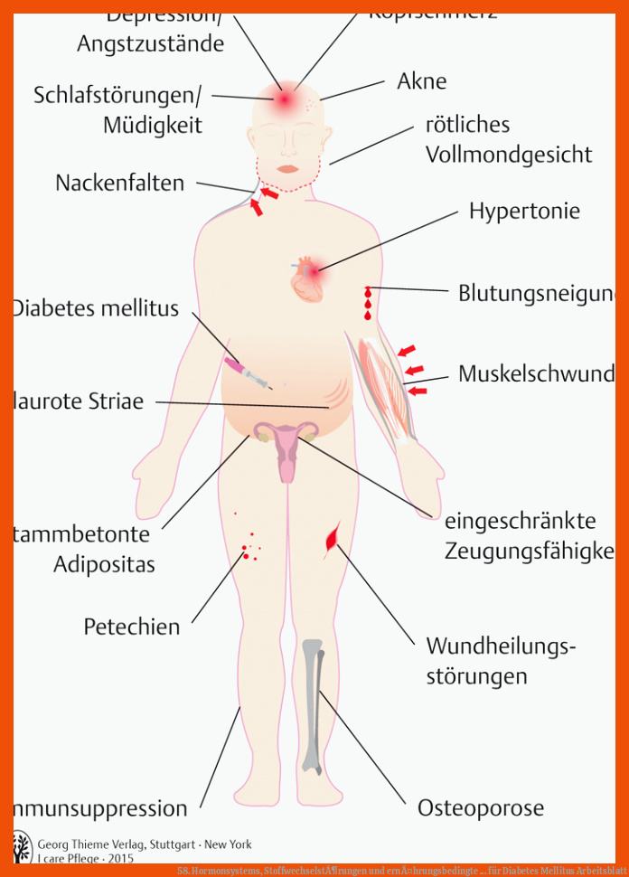 58. Hormonsystems, StoffwechselstÃ¶rungen und ernÃ¤hrungsbedingte ... für diabetes mellitus arbeitsblatt