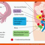 64. Geschlechtsorgane - PflegepÃ¤dagogik - Georg Thieme Verlag Fuer Männliche Geschlechtsorgane Arbeitsblatt