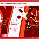 Blutgerinnung-verklumpung Â» Dr. Stephan Fuer Blutgerinnung Und Wundverschluss Arbeitsblatt
