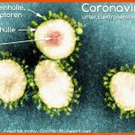 Coronavirus Sars-cov-2: Aufbau, Funktion Und Immunabwehr Fuer Viren Aufbau Arbeitsblatt