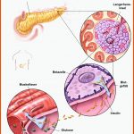 Diabetes: Wie KÃ¶nnten Stammzellen Helfen? Eurostemcell Fuer Diabetes Mellitus Arbeitsblatt
