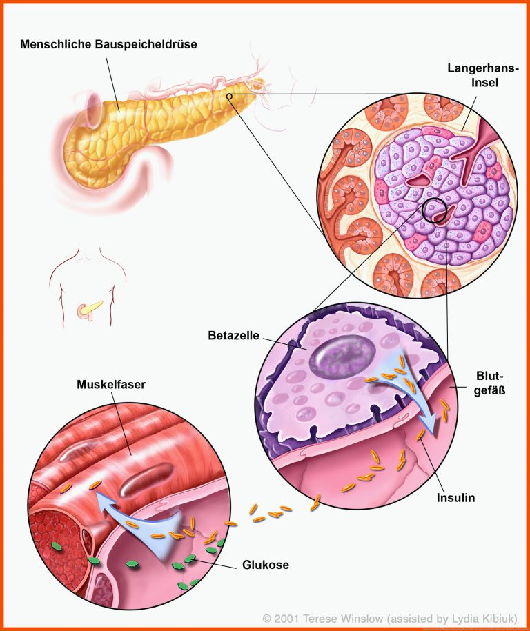 Diabetes: Wie kÃ¶nnten Stammzellen helfen? | Eurostemcell für diabetes mellitus arbeitsblatt