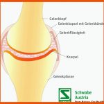 Gelenke â Aufbau, formen & Krankheiten Schwabe Austria Fuer Aufbau Eines Gelenks Arbeitsblatt