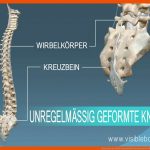 Kenntnis Der Skelettanatomie Knochenarten Fuer Knochenarten Arbeitsblatt