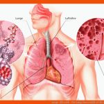 Lunge-zÃ¼rich - Die Lunge Kurz ErklÃ¤rt Fuer Aufbau Der Lunge Arbeitsblatt