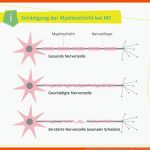 Multiple Sklerose: Angriff Auf Das Zentrale Nervensystem (zns ... Fuer Nervensystem Arbeitsblatt Pdf