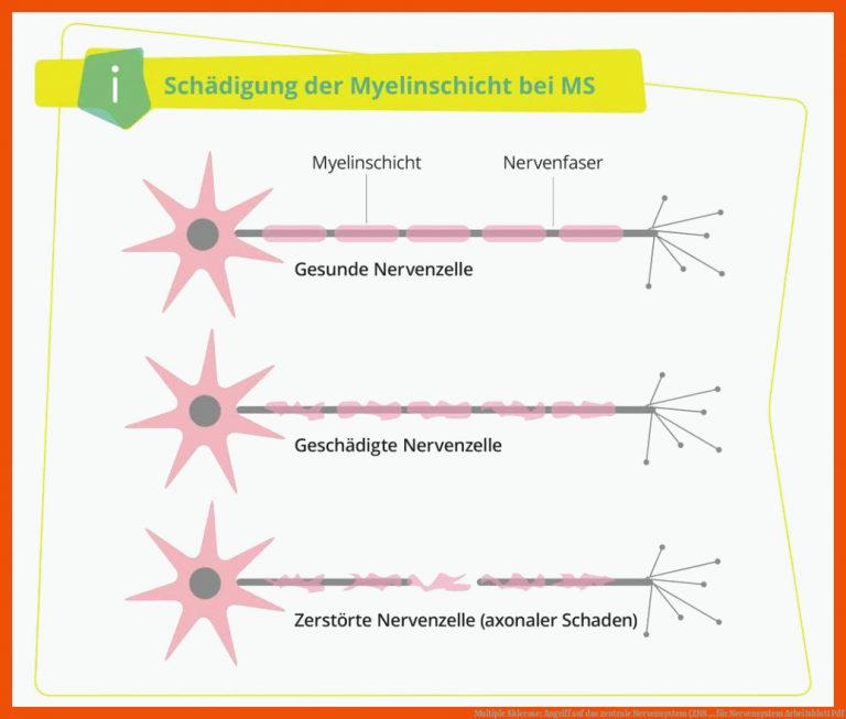 Multiple Sklerose: Angriff Auf Das Zentrale Nervensystem (zns ... Fuer Nervensystem Arbeitsblatt Pdf
